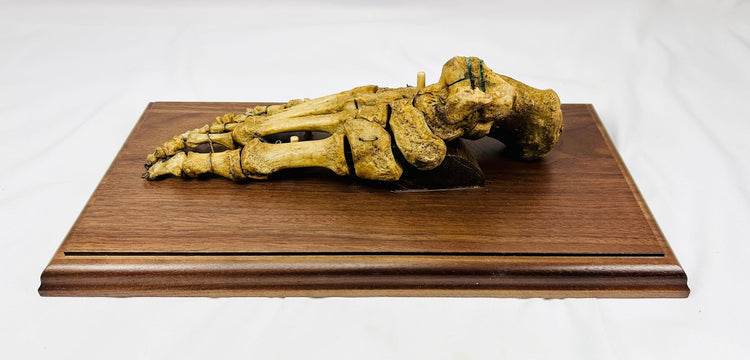 Close-up of human foot bones showing articulation and wiring, 19th century