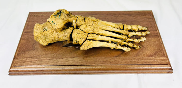 Historic human foot skeletal specimen prepared for anatomical study