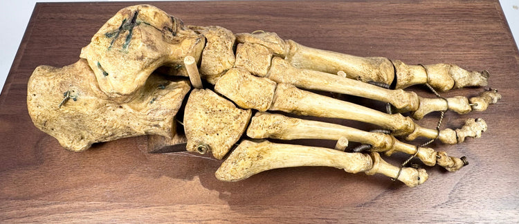 Rare 19th century anatomical human foot skeleton professionally articulated and displayed on a hardwood base
