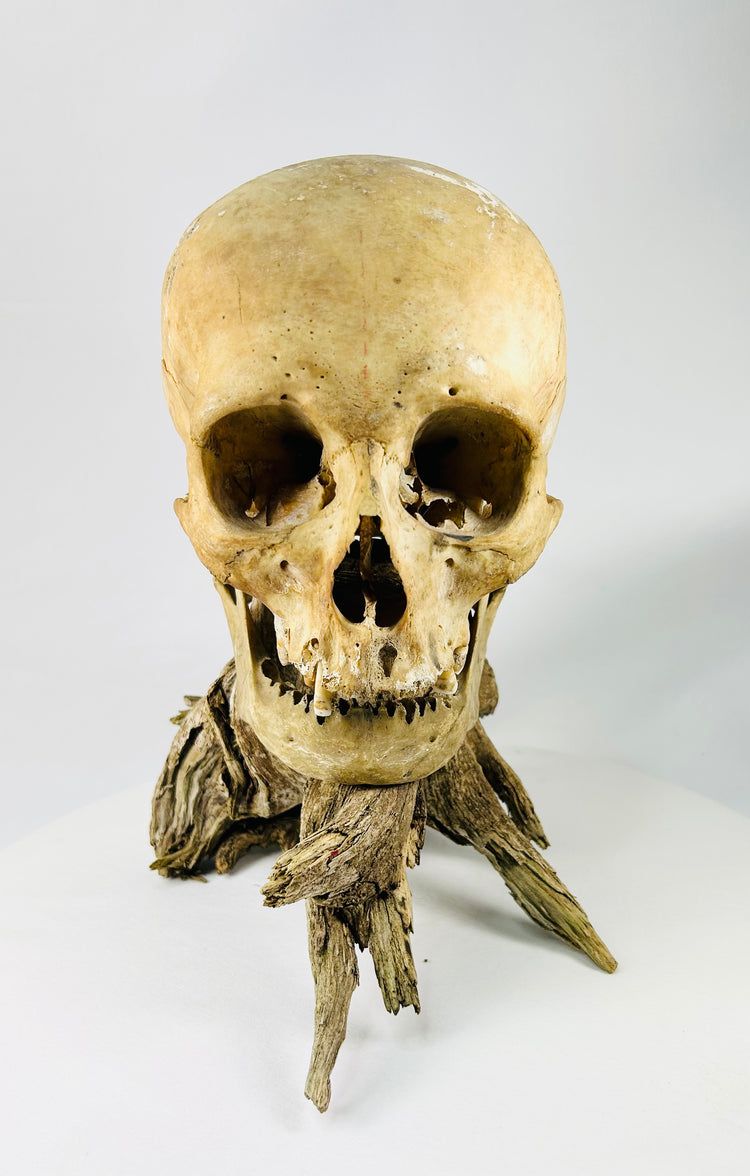Antique human skull mounted on driftwood base — frontal view under neutral lighting.