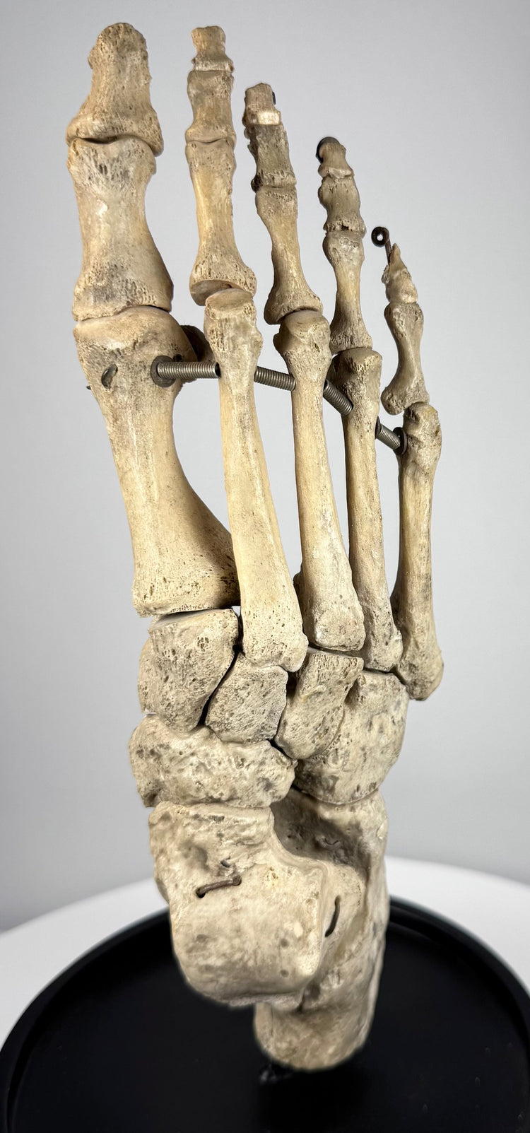 Antique human foot anatomy display beneath protective glass dome on black hardwood base, circa 1900–1930
