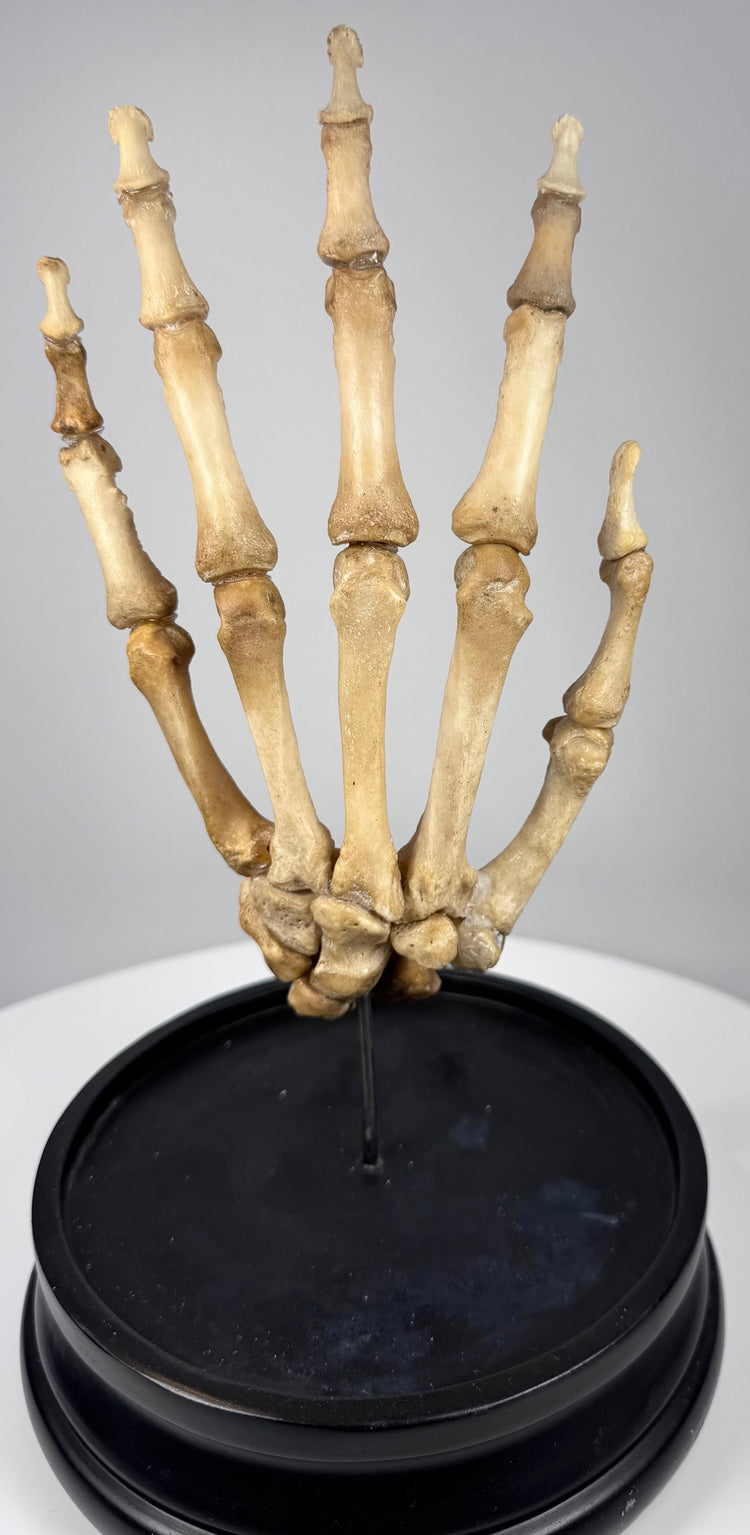 Historic human anatomy teaching specimen featuring a complete articulated skeletal hand from early 20th century London