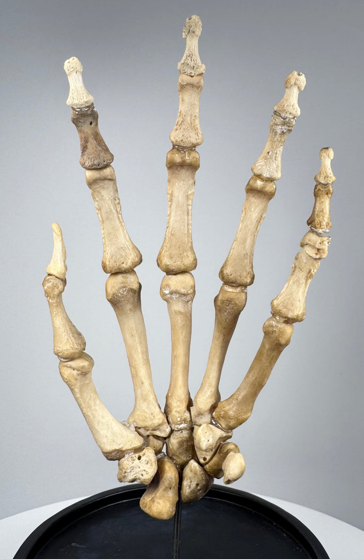 Museum-quality antique human hand skeleton displaying complete finger, palm and wrist bone structure