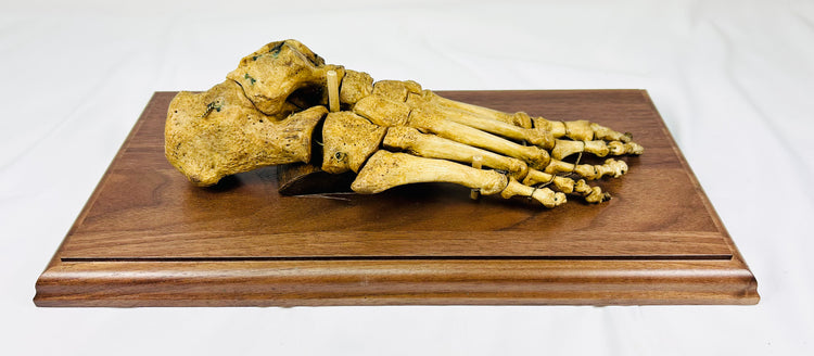 Antique Human Foot Bone Specimen | Mounted on Wooden Base | 19th Century