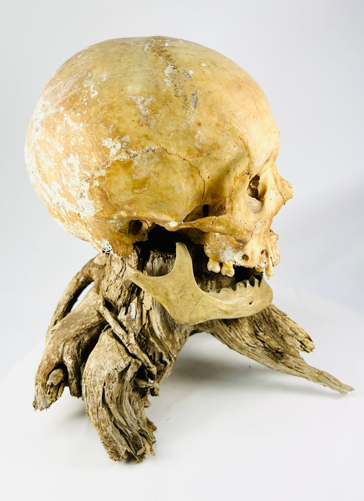 19th-century anatomical skull — low angle showing natural coloration and patina