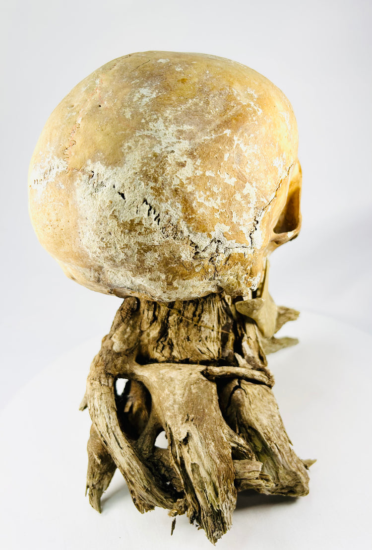 Antique medical specimen skull — rear-left view showing occipital and parietal bones