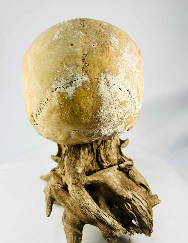 Human skull mounted for display — right-rear view with natural bone tone preserved