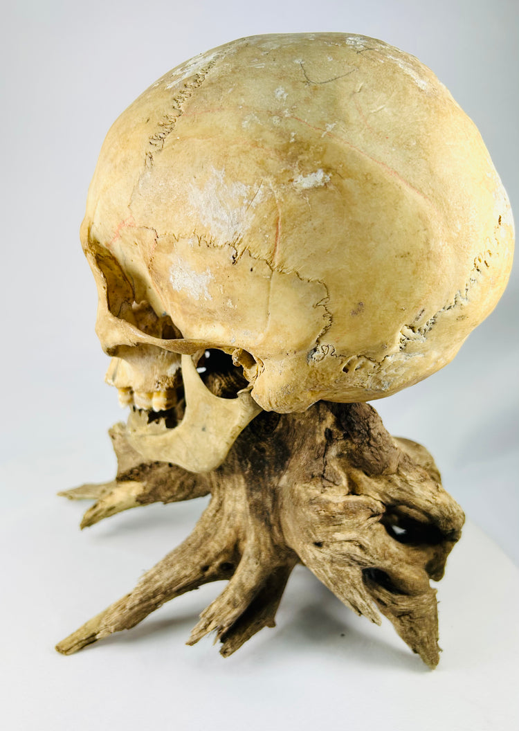 Antique skull close-up — mandible and cranial base visible on weathered stand