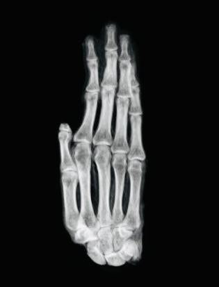 X-ray image of an ancient Egyptian mummified hand showing preserved bone structure, Late Period 700–200 BCE artifact.