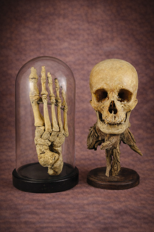 Antique human skeletal foot specimen displayed under a glass dome beside a genuine human skull mounted on a wooden stand against a warm brown studio background.