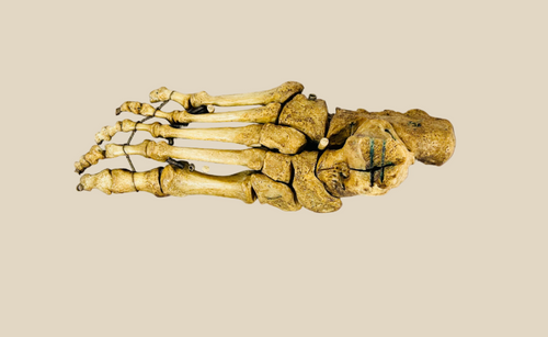 Articulated 19th century human foot skeleton mounted on polished hardwood base, with wired bones preserving natural anatomical structure for medical study and educational purposes