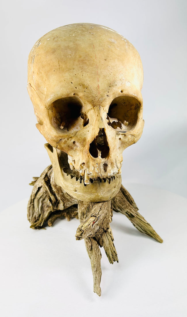 Antique human anatomical skull displayed on driftwood stand, photographed against a white background — 19th-century specimen from Relic &amp; Rarity.