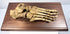 Antique human skeletal foot with articulated bones and original wiring mounted on a wooden anatomical display base