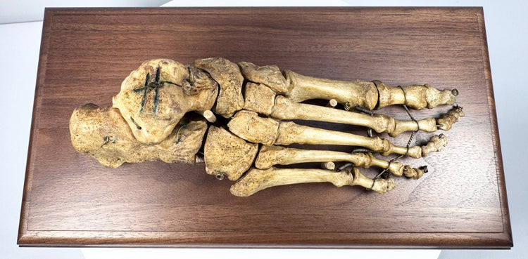 Historic human foot anatomy specimen mounted on hardwood base for 19th century medical education and study