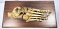 Historic human foot anatomy specimen mounted on hardwood base for 19th century medical education and study