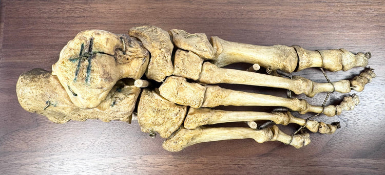 Antique medical teaching specimen featuring an articulated human foot skeleton with aged bone patina and original-style mounting