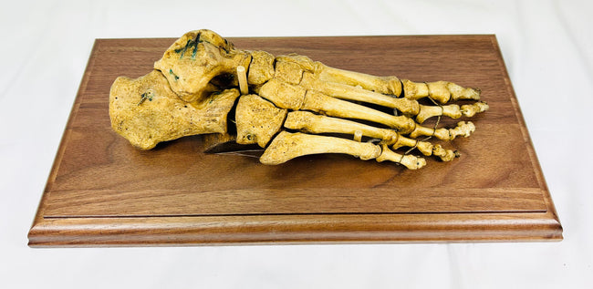 Historic human foot skeletal specimen prepared for anatomical study