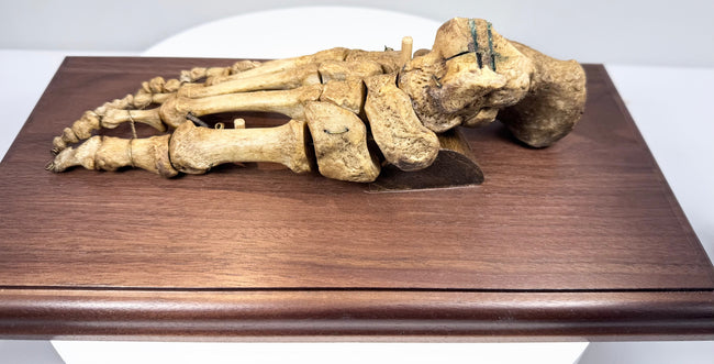 19th century European osteological specimen of a human foot with wired bones and polished wooden display mount