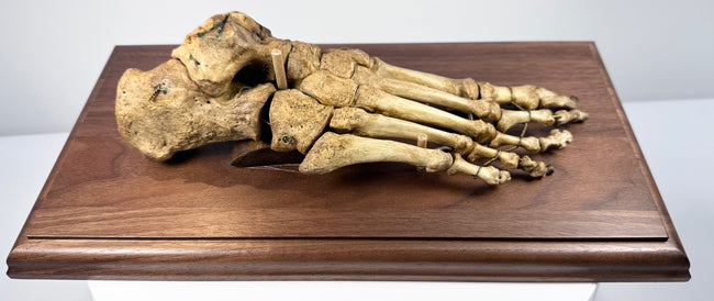 Side view of 19th century human foot skeleton showing articulated toe, metatarsal, tarsal and heel bones
