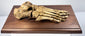 Side view of 19th century human foot skeleton showing articulated toe, metatarsal, tarsal and heel bones