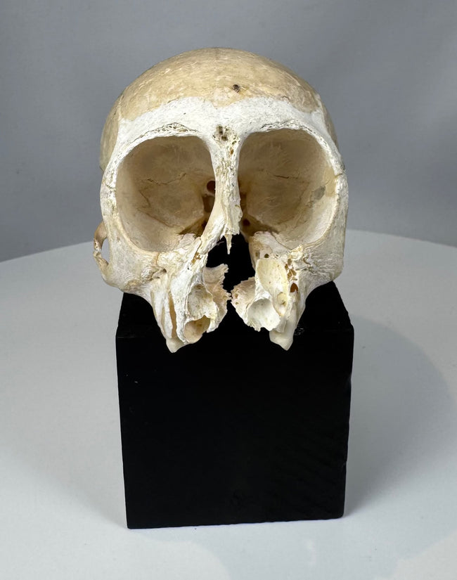 Preserved primate skull displaying exposed anatomical structures, cranial sutures, and surviving dentition.