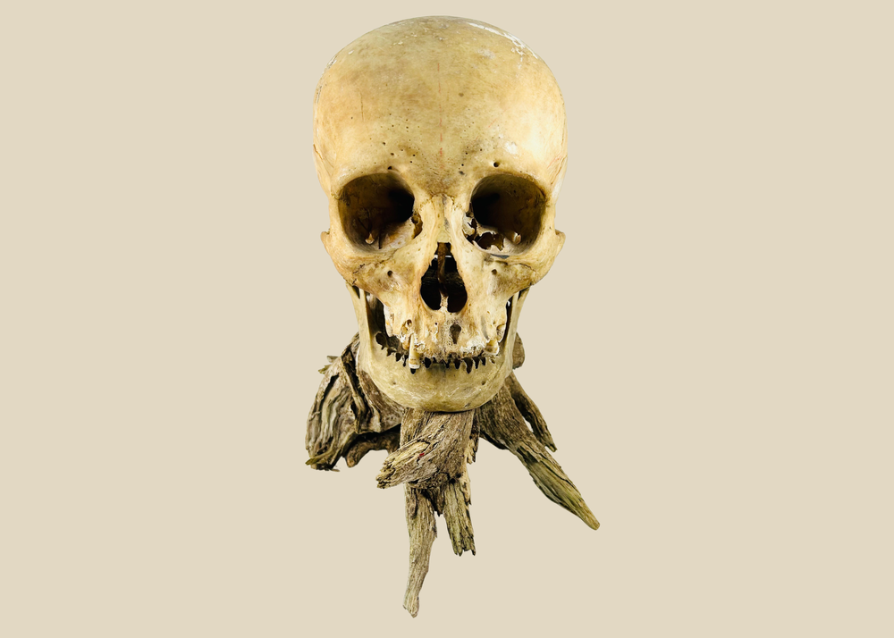 Authentic antique human skull displayed on a natural driftwood base, photographed against a white background. Museum-quality anatomical specimen offered by Relic and Rarity.
