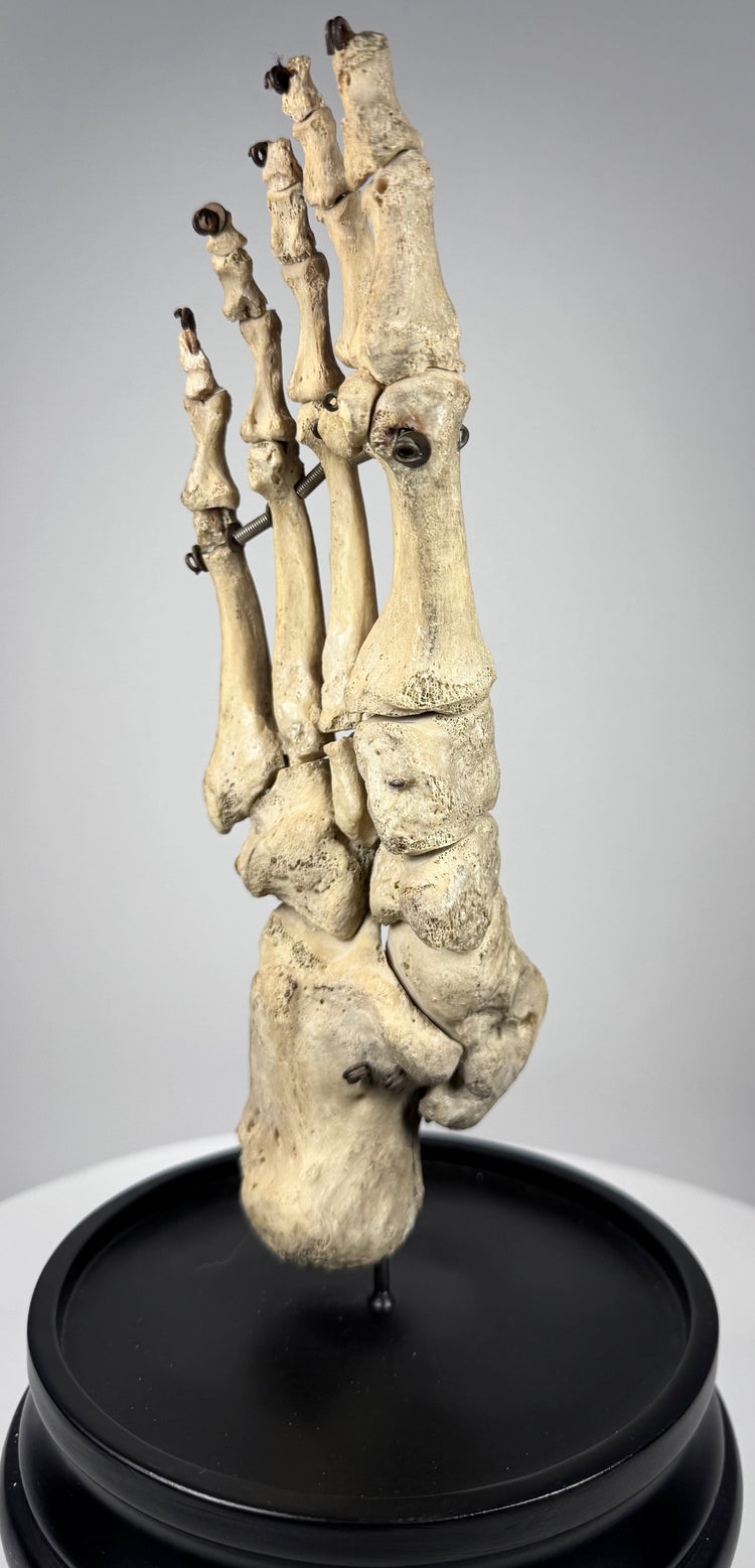 Close-up of antique human foot bones showing aged surface patina, anatomical structure and metal articulation hardware