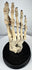 Front view of antique human foot skeleton showing articulated toe, metatarsal, tarsal and ankle bones