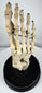 Front view of antique human foot skeleton showing articulated toe, metatarsal, tarsal and ankle bones