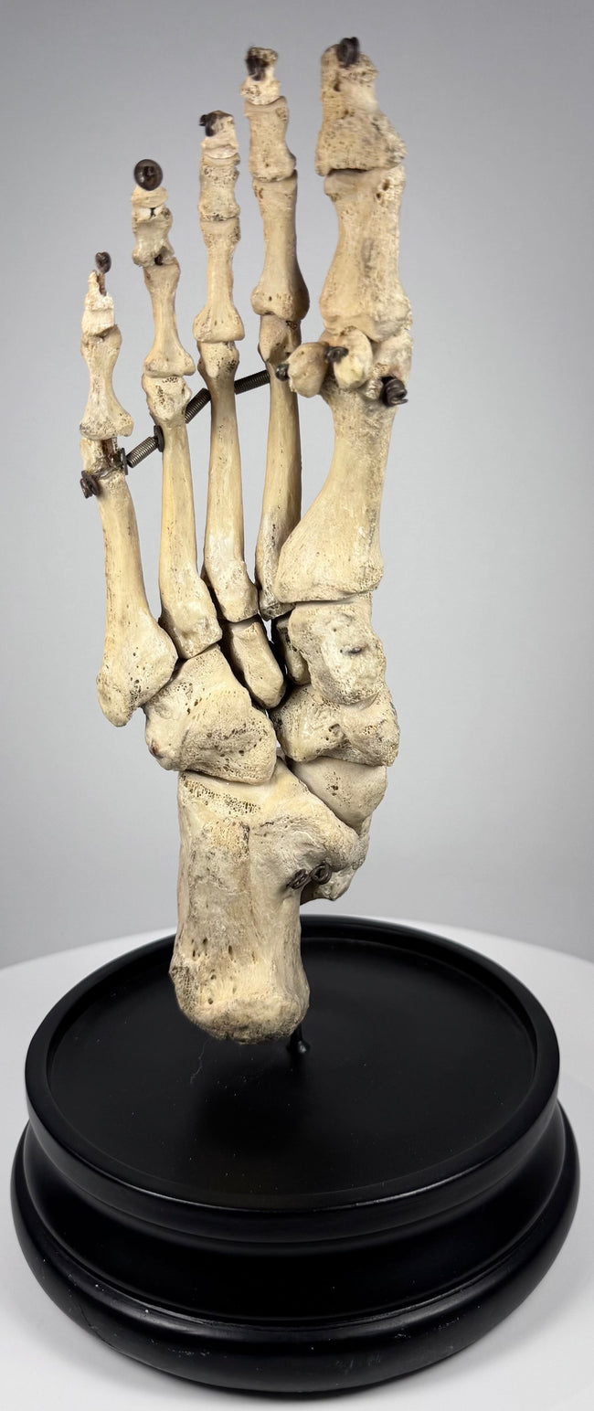 Historic human skeletal foot teaching specimen displaying articulated phalanges, metatarsals and tarsal bones