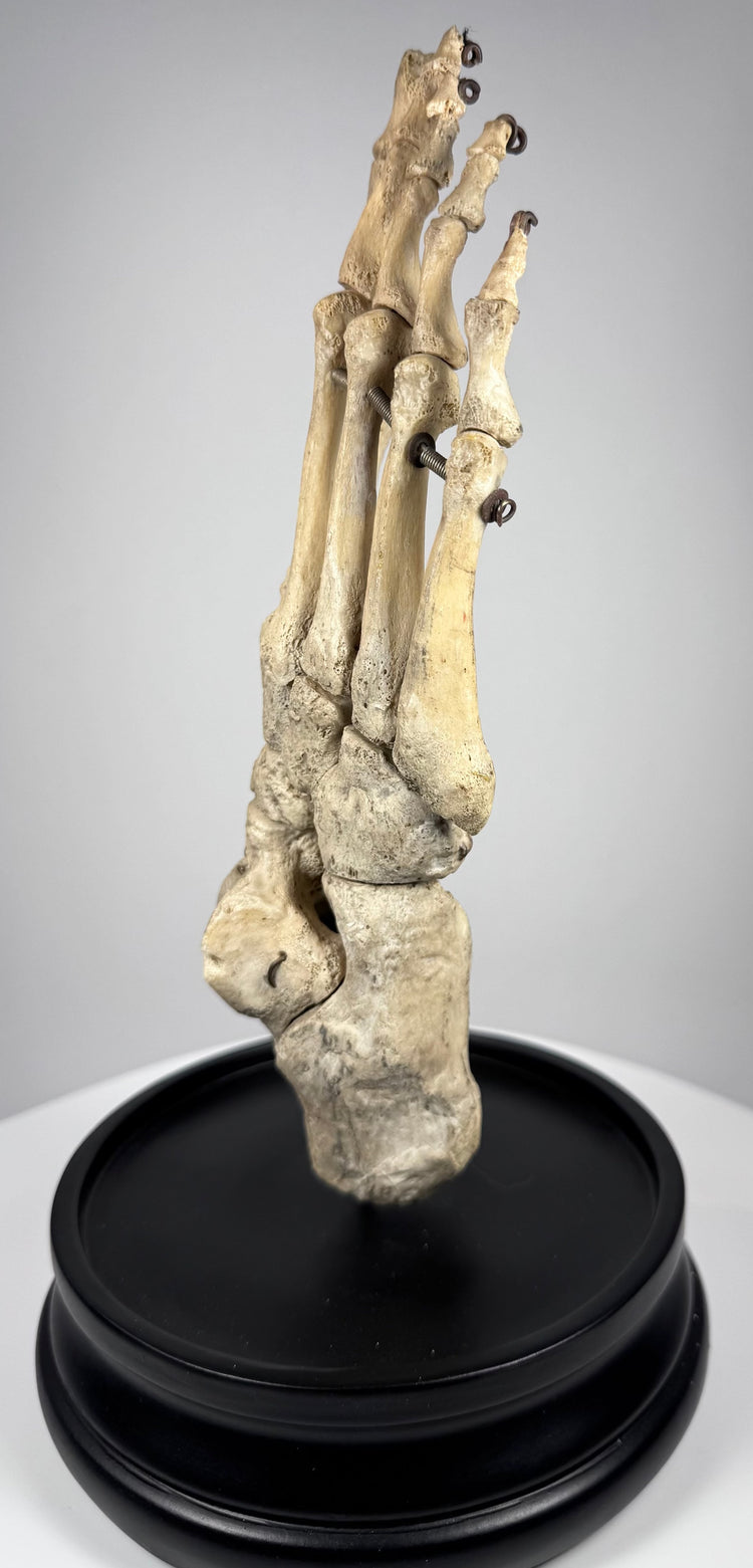 Detailed view of early 20th century human foot anatomy specimen mounted upright on a hardwood display base