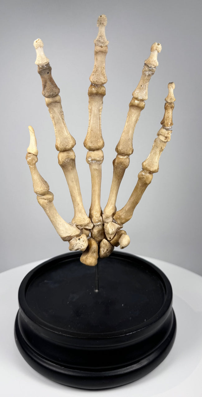 Early 20th century articulated human hand skeleton medical teaching specimen mounted on a black hardwood display base