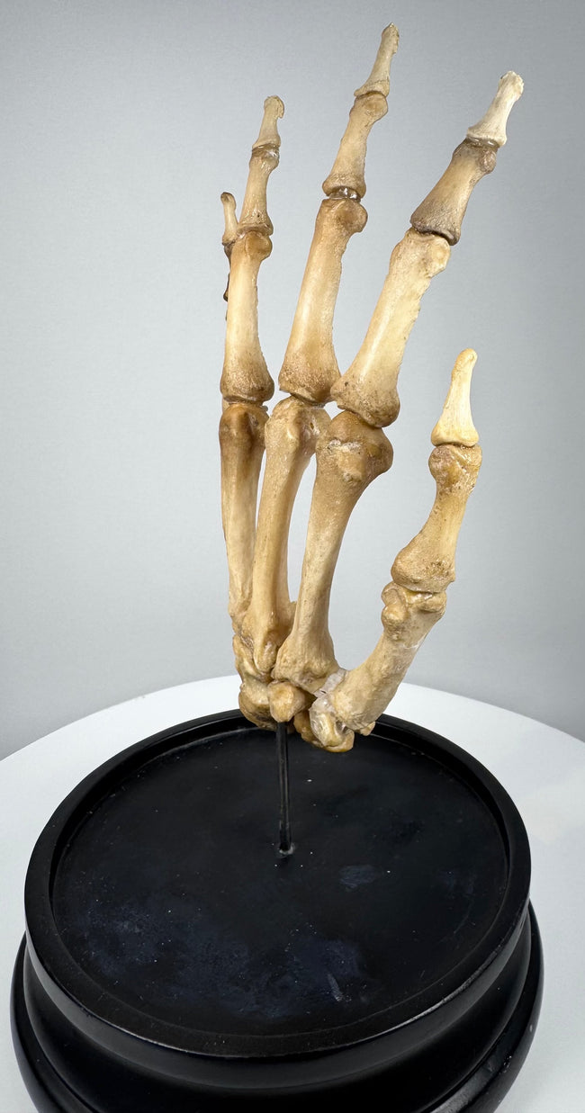 Three-quarter view of antique human skeletal hand medical specimen mounted upright on a hardwood base