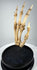 Three-quarter view of antique human skeletal hand medical specimen mounted upright on a hardwood base