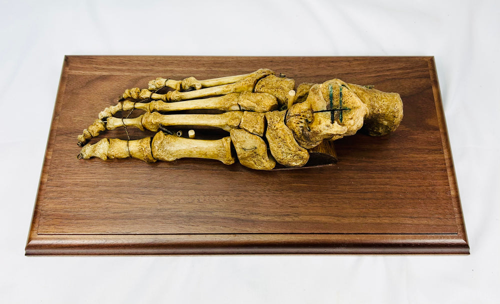 19th-century articulated human foot bone specimen mounted on wooden base