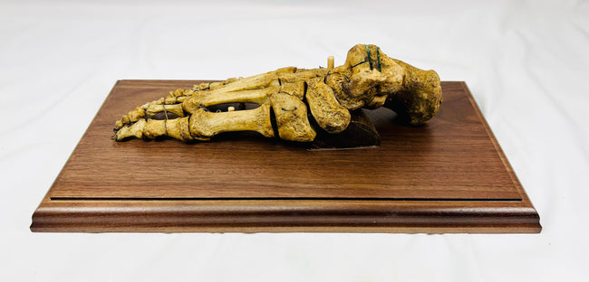 Close-up of human foot bones showing articulation and wiring, 19th century