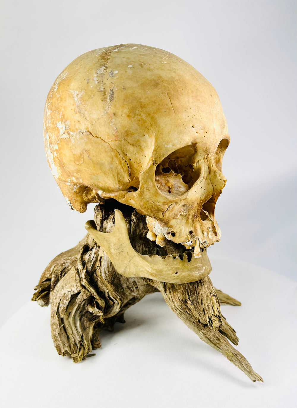 Historical human skull specimen — elevated angle emphasizing bone texture