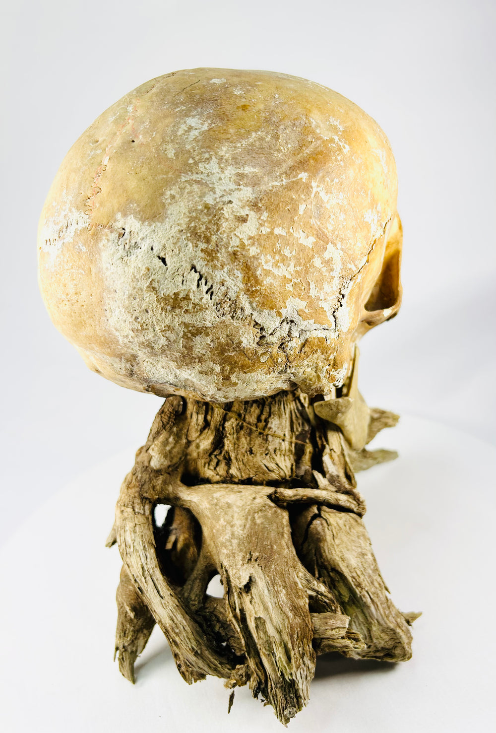 Antique medical specimen skull — rear-left view showing occipital and parietal bones