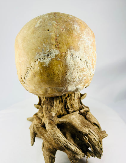 Human skull mounted for display — right-rear view with natural bone tone preserved
