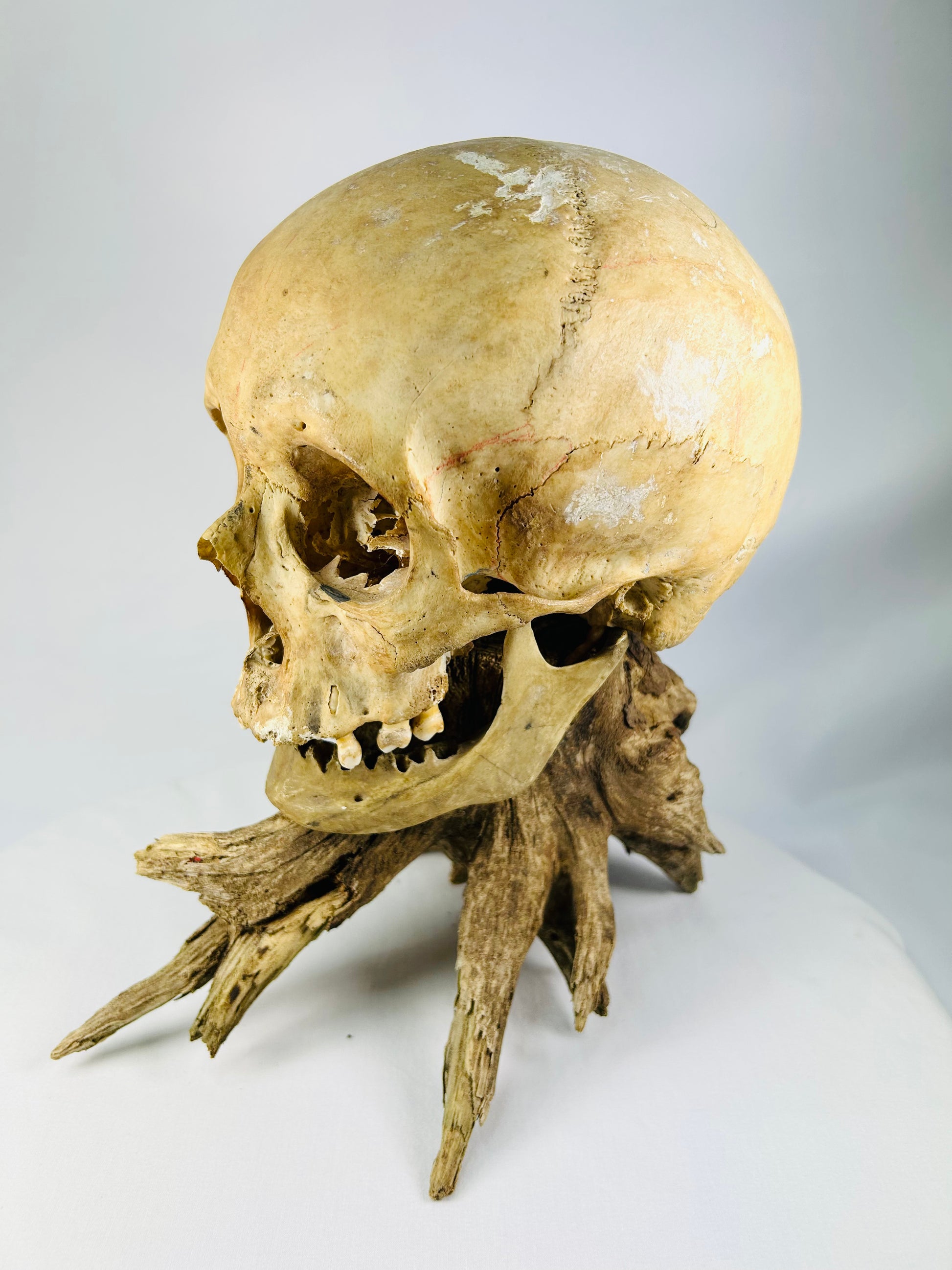 Forensic-grade anatomical skull — side profile emphasizing articulation and preservation