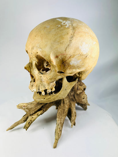 Forensic-grade anatomical skull — side profile emphasizing articulation and preservation