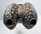 Tibetan Buddhist Chöd Instrument with Human Femur Bone and Decorative Fittings