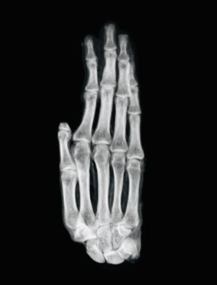 X-ray image of an ancient Egyptian mummified hand showing preserved bone structure, Late Period 700–200 BCE artifact.