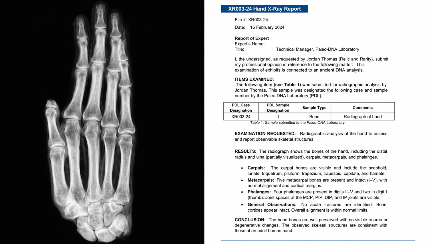 X-ray image of a mummified hand displayed beside a detailed radiographic analysis report document on a dark background