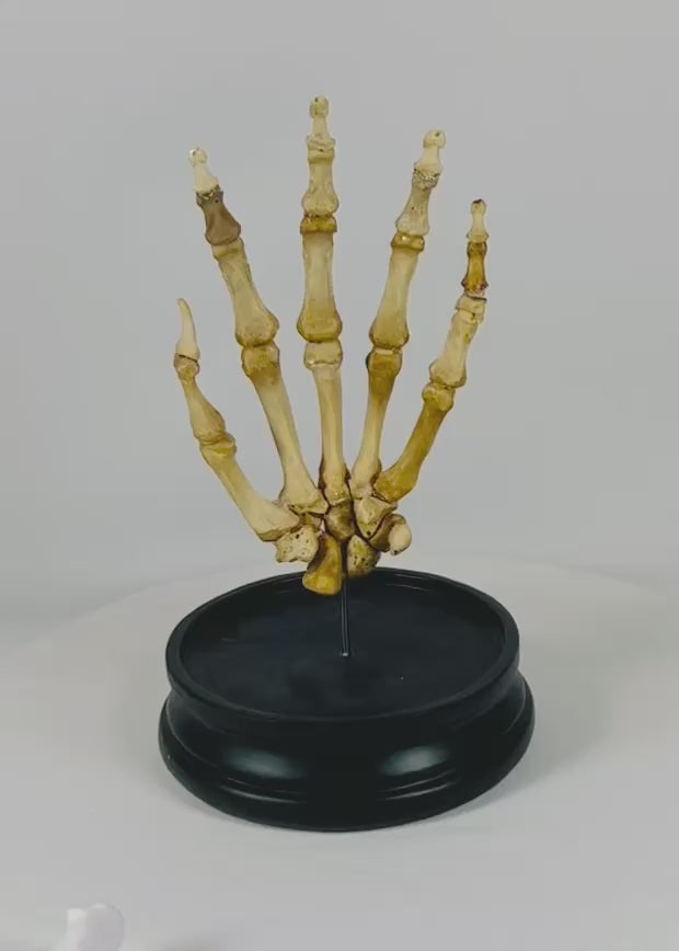 Video showing an early 20th-century articulated human skeletal hand mounted under a glass dome, highlighting bone structure, joints, and display base.