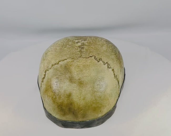 19th-century Tibetan Kapala ritual skull cup crafted from human bone with visible cranial sutures and silver rim, used in Tantric Buddhist meditation rituals.