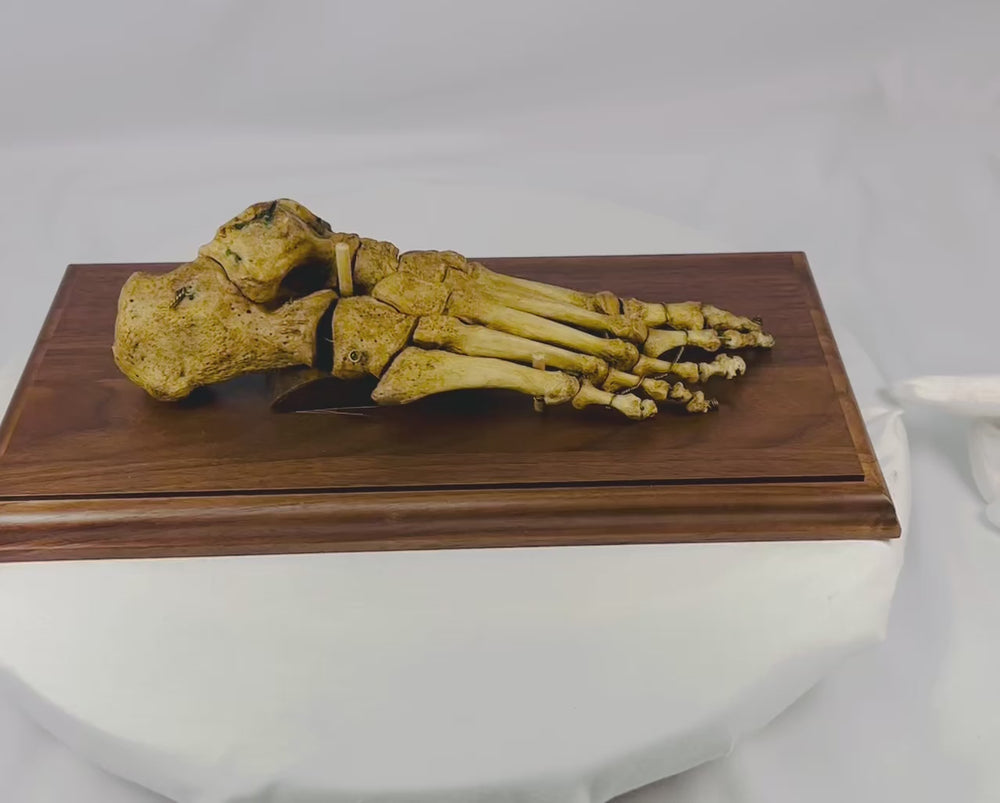 Video showing a 19th-century articulated human foot bone specimen mounted on a wooden base, highlighting bone structure, wiring, and anatomical detail.